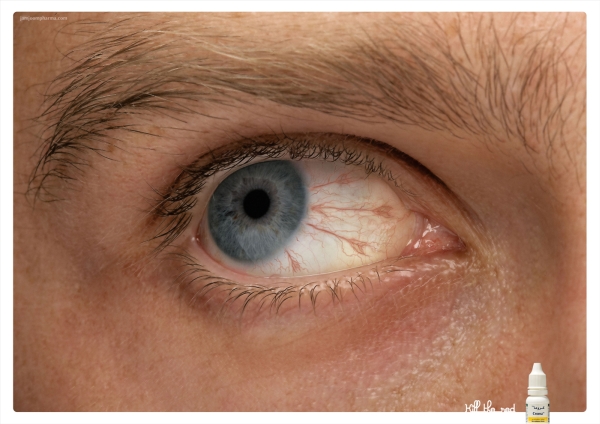 Реклама Croma Eye Drops 