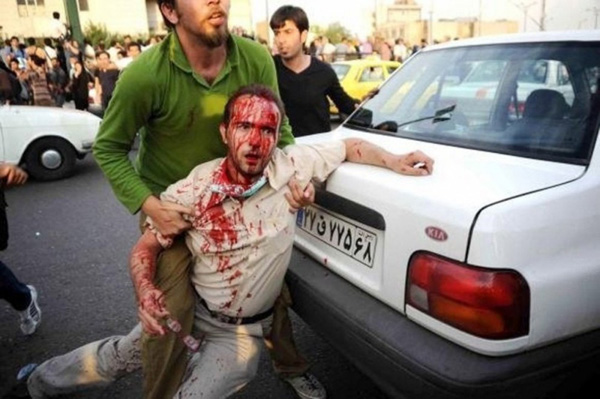 Раненый мужчин в Тегеране