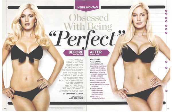 Хейди Монтаг (Heidi Montag) plastic surgery