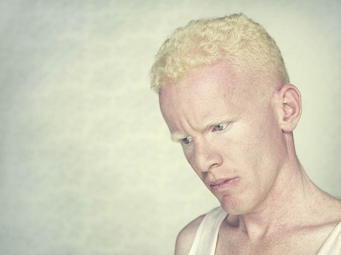 Gustavo Lacerda - Albinos 019.jpeg