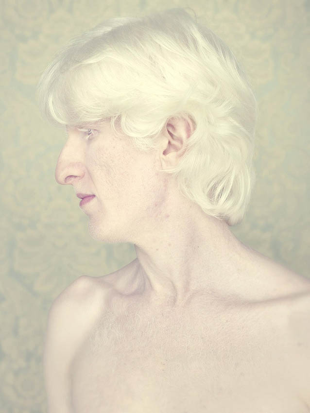 Gustavo-Lacerda-Albinos-1.jpg