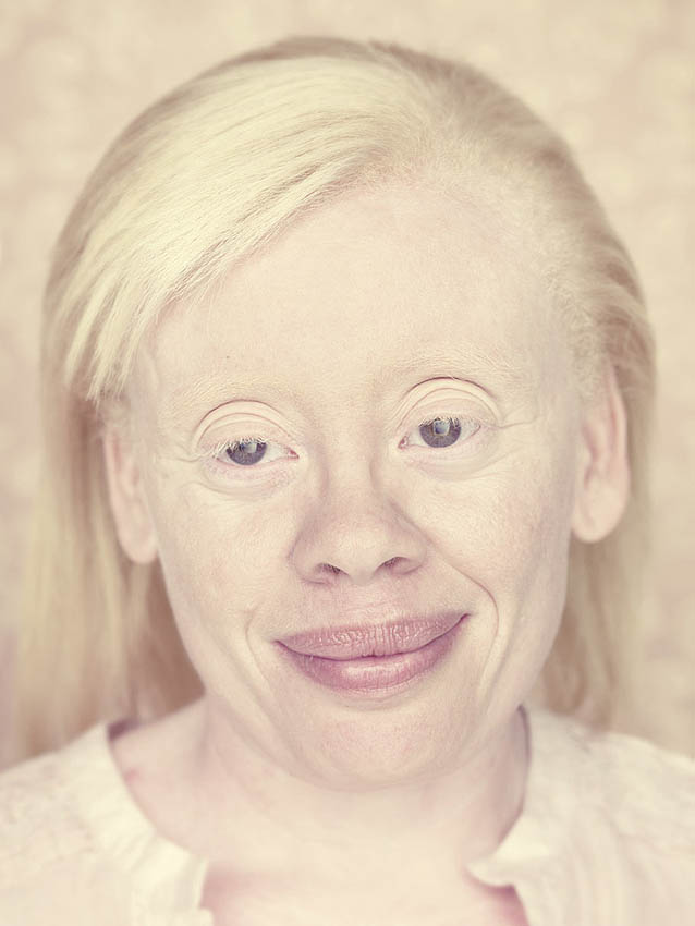 Gustavo-Lacerda-Albinos-2.jpg
