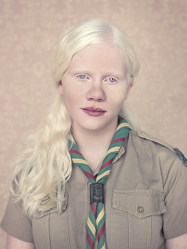 Gustavo-Lacerda-Albinos-3.jpg